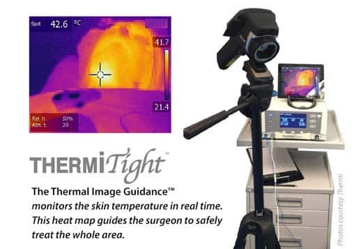 ThermiTight heat map