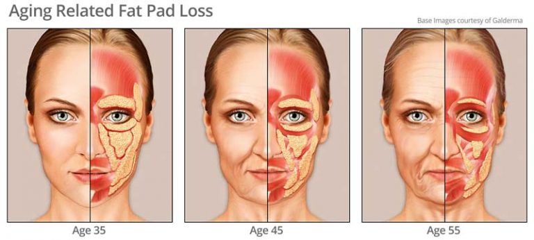 What Happens To Your Face And Skin As You Age Video • Rejuvent Medical