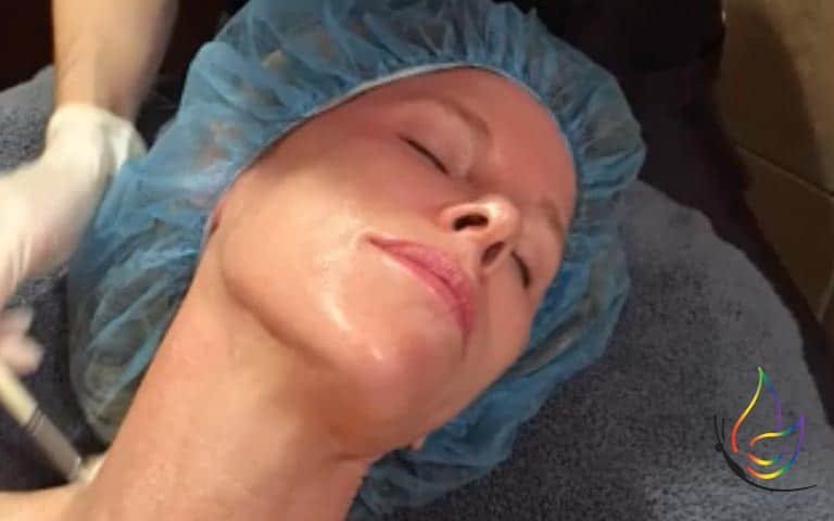 What a good regimen for chemical peels