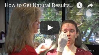 How to Get Natural Results with Botox