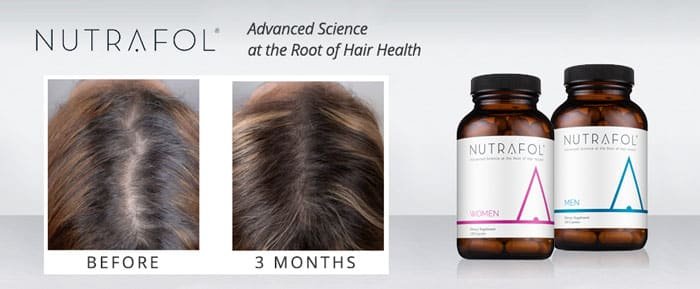 Nutrafol intro banner with before and after image