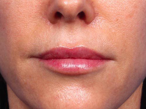 Closeup of Dr. Bomer's lips at 53